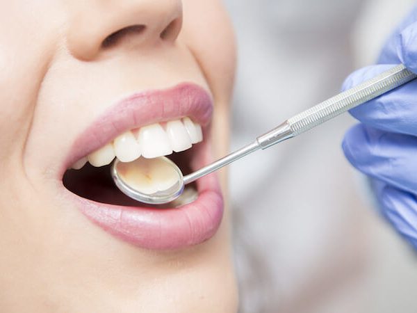 Keine Fixpreise für Zahnreinigung und Bleaching Keine Fixpreise für Zahnreinigung und Bleaching